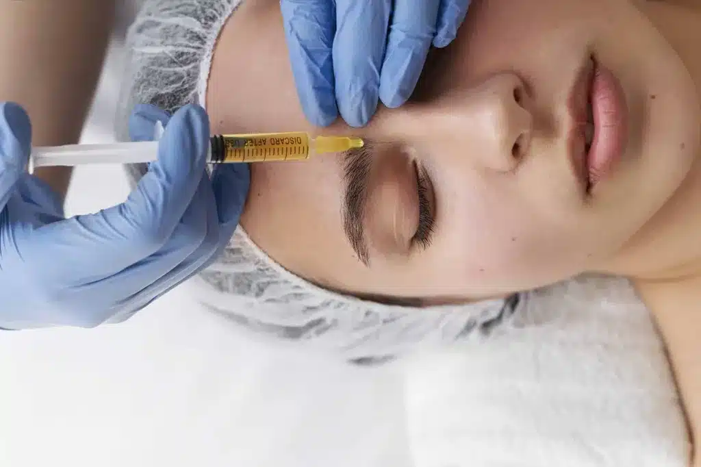 PRP tretman lica u Alfa Estetika ordinaciji