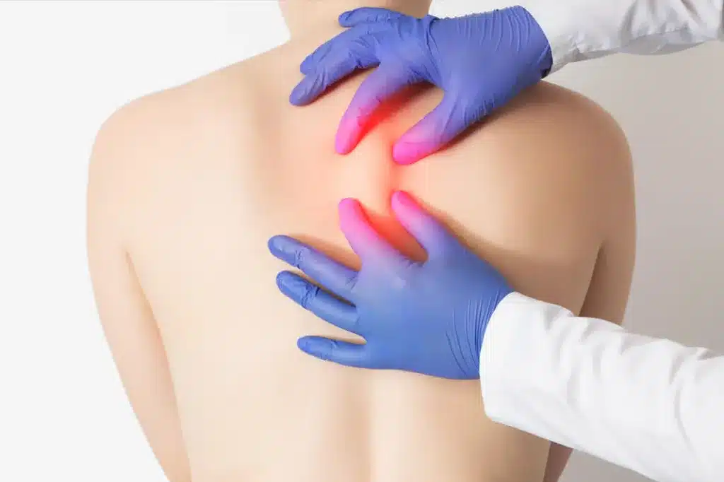 Uklanjanje ateroma u Alfa Estetika ordinaciji